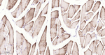 ADFP Antibody in Immunohistochemistry (Paraffin) (IHC (P))