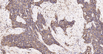 CD44 Antibody in Immunohistochemistry (Paraffin) (IHC (P))