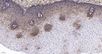 CD44 Antibody in Immunohistochemistry (Paraffin) (IHC (P))
