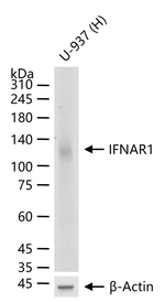 IFNAR1 Recombinant Rabbit Monoclonal Antibody (12B4)