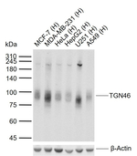 TGN46 Recombinant Rabbit Monoclonal Antibody (18D19)