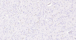 ABCB1 Antibody in Immunohistochemistry (Paraffin) (IHC (P))