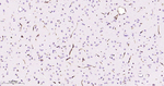 ABCB1 Antibody in Immunohistochemistry (Paraffin) (IHC (P))