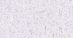 ABCB1 Recombinant Rabbit Monoclonal Antibody (2C11)