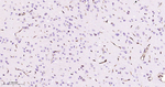 ABCB1 Antibody in Immunohistochemistry (Paraffin) (IHC (P))