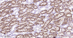ABCB1 Antibody in Immunohistochemistry (Paraffin) (IHC (P))