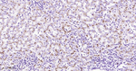 ABCB1 Antibody in Immunohistochemistry (Paraffin) (IHC (P))
