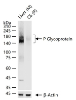 ABCB1 Antibody in Western Blot (WB)