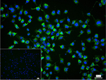 Collagen III Recombinant Rabbit Monoclonal Antibody (7E8)