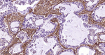 Collagen III Antibody in Immunohistochemistry (Paraffin) (IHC (P))