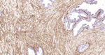 Collagen III Antibody in Immunohistochemistry (Paraffin) (IHC (P))