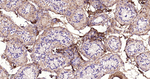 Collagen III Antibody in Immunohistochemistry (Paraffin) (IHC (P))
