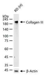 Collagen III Antibody in Western Blot (WB)