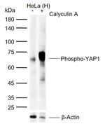 Phospho-YAP1 (Ser127) Antibody in Western Blot (WB)