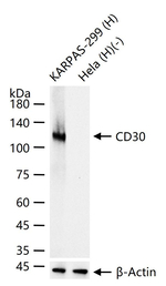CD30 Antibody in Western Blot (WB)