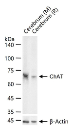 ChAT Antibody in Western Blot (WB)