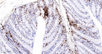S100A4 Antibody in Immunohistochemistry (Paraffin) (IHC (P))