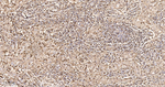 S100A4 Antibody in Immunohistochemistry (Paraffin) (IHC (P))