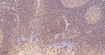 S100A4 Antibody in Immunohistochemistry (Paraffin) (IHC (P))