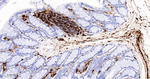 S100A4 Antibody in Immunohistochemistry (Paraffin) (IHC (P))