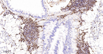 S100A4 Antibody in Immunohistochemistry (Paraffin) (IHC (P))