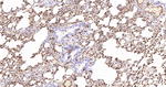 S100A4 Antibody in Immunohistochemistry (Paraffin) (IHC (P))