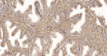 S100A4 Recombinant Rabbit Monoclonal Antibody (SB100)
