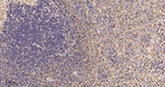 S100A4 Antibody in Immunohistochemistry (Paraffin) (IHC (P))