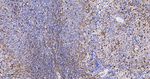 S100A4 Antibody in Immunohistochemistry (Paraffin) (IHC (P))