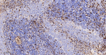 S100A4 Antibody in Immunohistochemistry (Paraffin) (IHC (P))