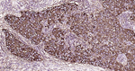 MUC1 Antibody in Immunohistochemistry (Paraffin) (IHC (P))