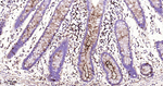 MUC1 Antibody in Immunohistochemistry (Paraffin) (IHC (P))