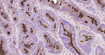 MUC1 Antibody in Immunohistochemistry (Paraffin) (IHC (P))