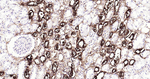 MUC1 Antibody in Immunohistochemistry (Paraffin) (IHC (P))