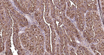 MUC1 Recombinant Rabbit Monoclonal Antibody (SB48)