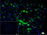 TGM2 Monoclonal Antibody (SB103)