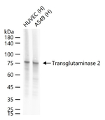 TGM2 Antibody in Western Blot (WB)