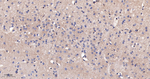 beta Catenin Antibody in Immunohistochemistry (Paraffin) (IHC (P))
