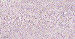 beta Catenin Antibody in Immunohistochemistry (Paraffin) (IHC (P))