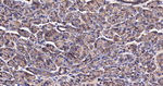 beta Catenin Antibody in Immunohistochemistry (Paraffin) (IHC (P))