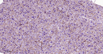 beta Catenin Antibody in Immunohistochemistry (Paraffin) (IHC (P))