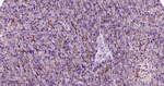 beta Catenin Antibody in Immunohistochemistry (Paraffin) (IHC (P))