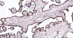 beta Catenin Antibody in Immunohistochemistry (Paraffin) (IHC (P))