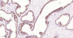 beta Catenin Recombinant Rabbit Monoclonal Antibody (SB65)