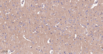 beta Catenin Antibody in Immunohistochemistry (Paraffin) (IHC (P))