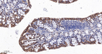 beta Catenin Antibody in Immunohistochemistry (Paraffin) (IHC (P))