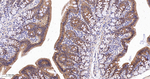 beta Catenin Antibody in Immunohistochemistry (Paraffin) (IHC (P))