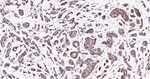 beta Catenin Antibody in Immunohistochemistry (Paraffin) (IHC (P))
