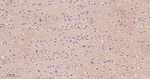 beta Catenin Antibody in Immunohistochemistry (Paraffin) (IHC (P))
