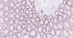 beta Catenin Antibody in Immunohistochemistry (Paraffin) (IHC (P))
